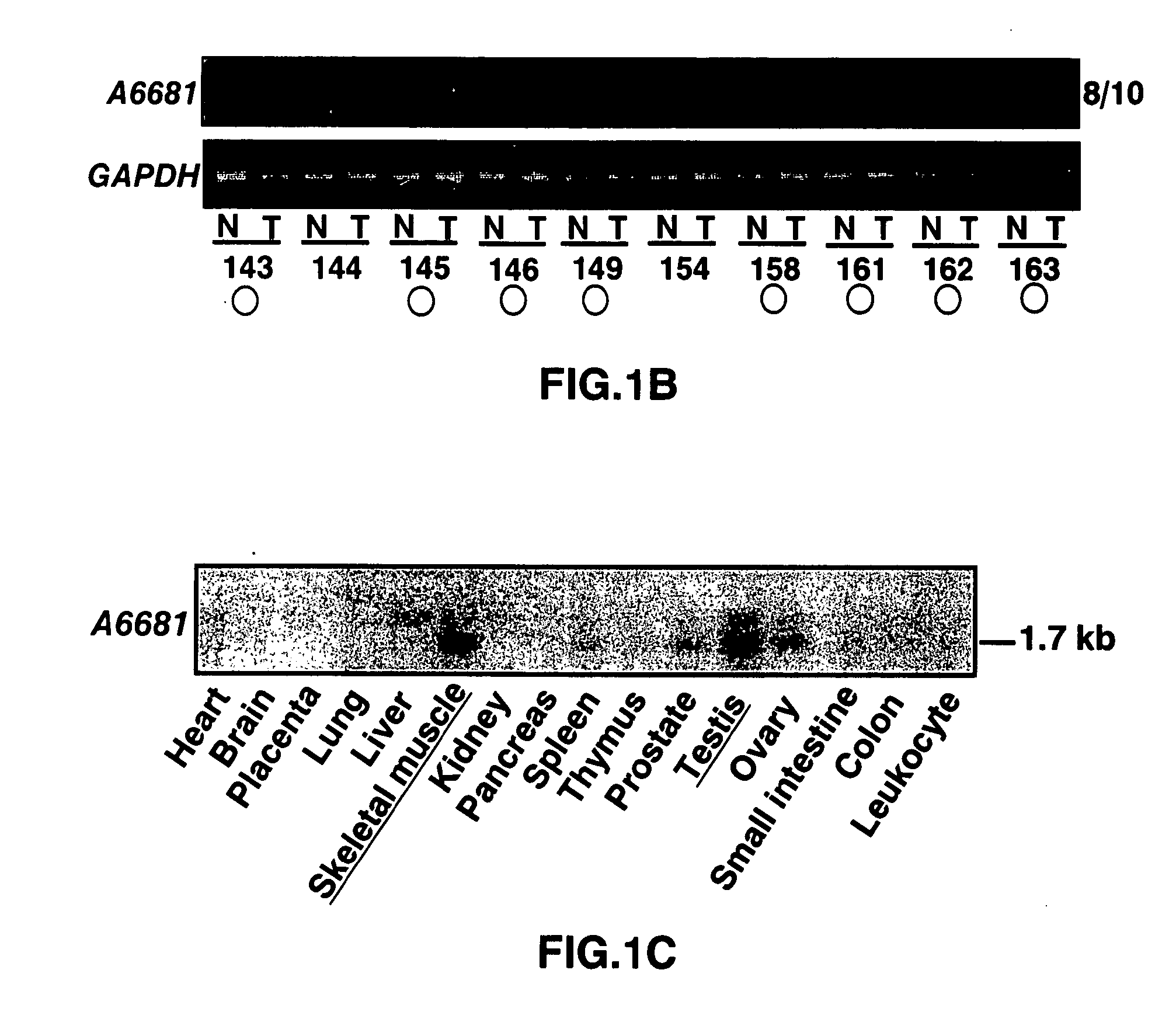 Gene and protein relating to hepatocellular carcinoma and methods of use thereof