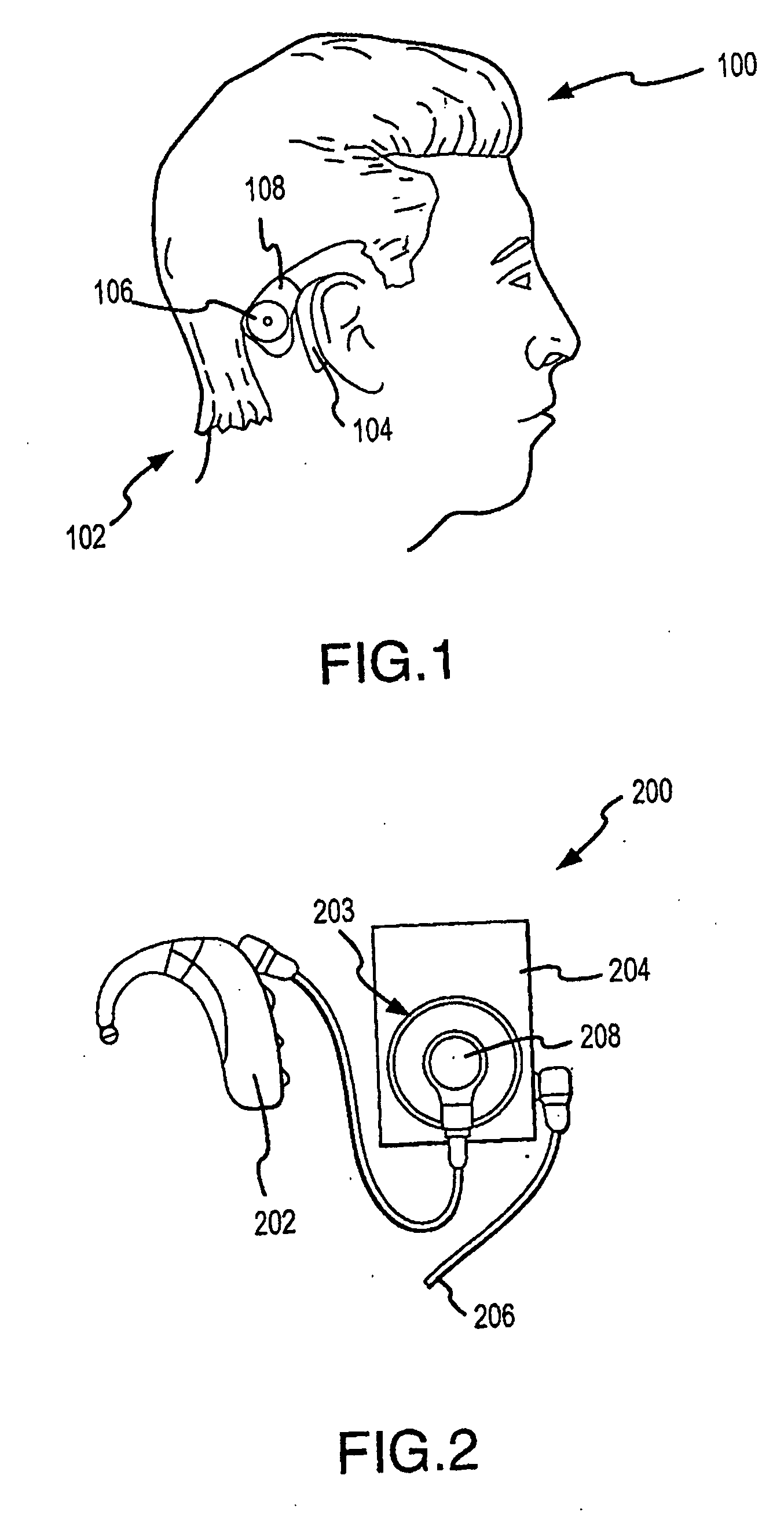 Method and apparatus for measuring the performance of an implantable middle ear hearing aid, and the response of a patient wearing such a hearing aid