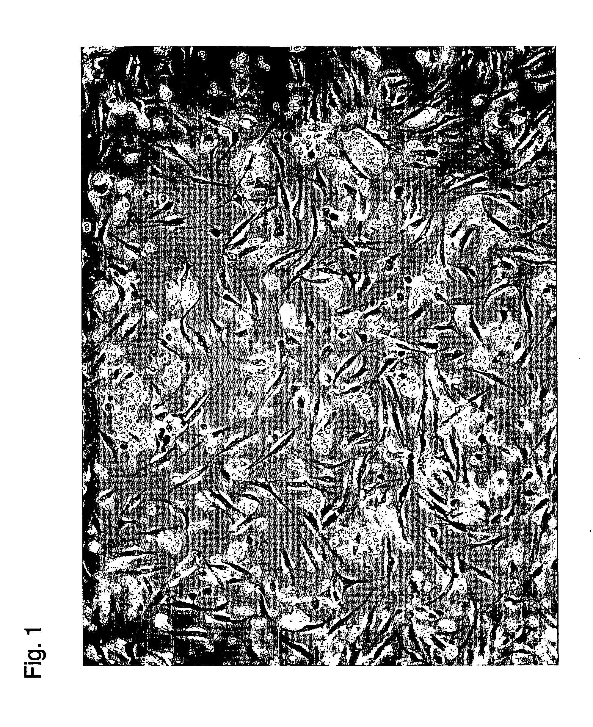 Method and system for preparing stem cells from fat tissue