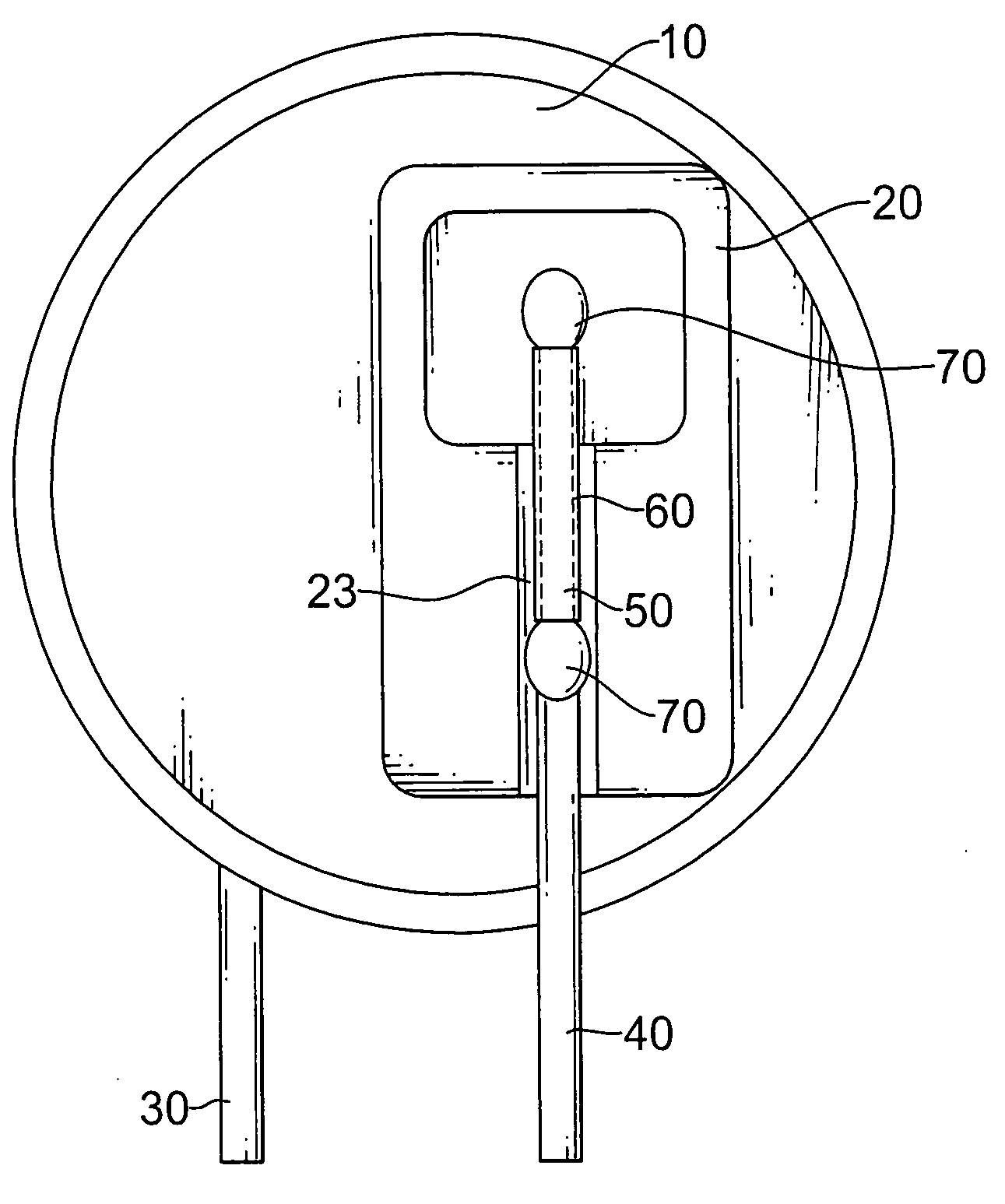 Metal oxide varistor with a heat protection