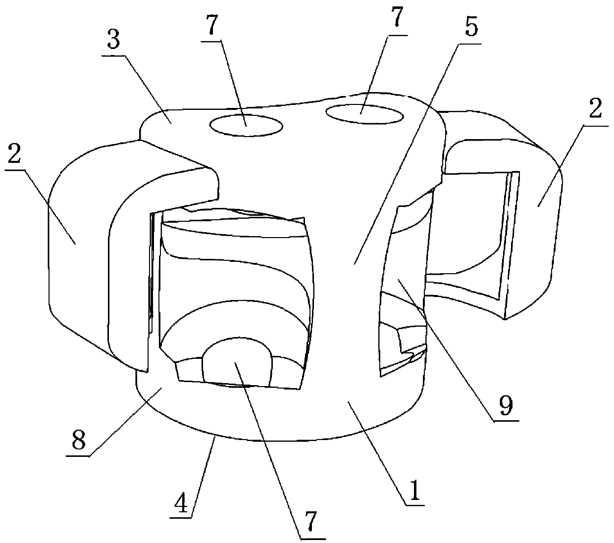 Personalized artificial vertebral body implant based on additive manufacturing and design method thereof