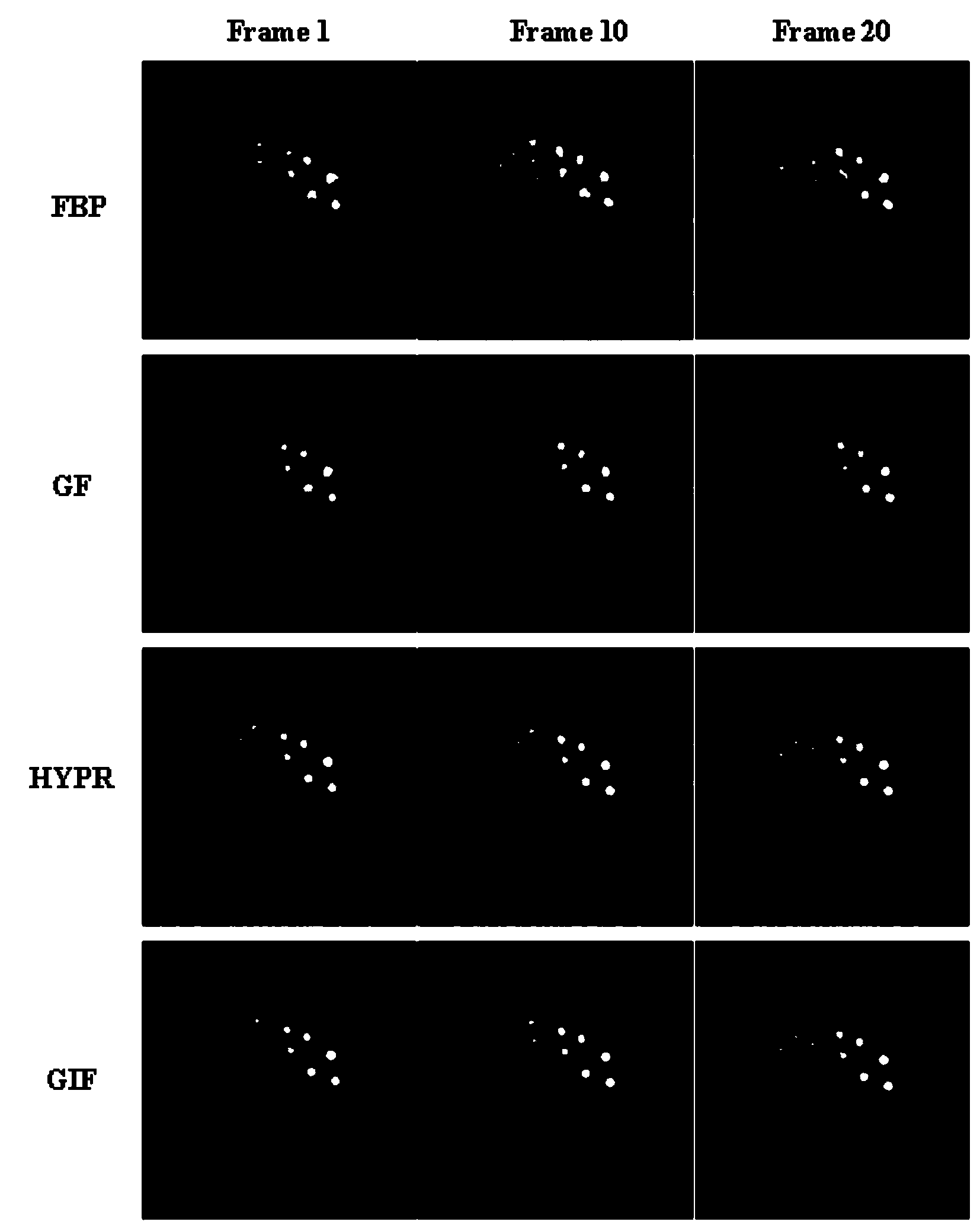 Dynamic PET image denoising method based on combined image guiding