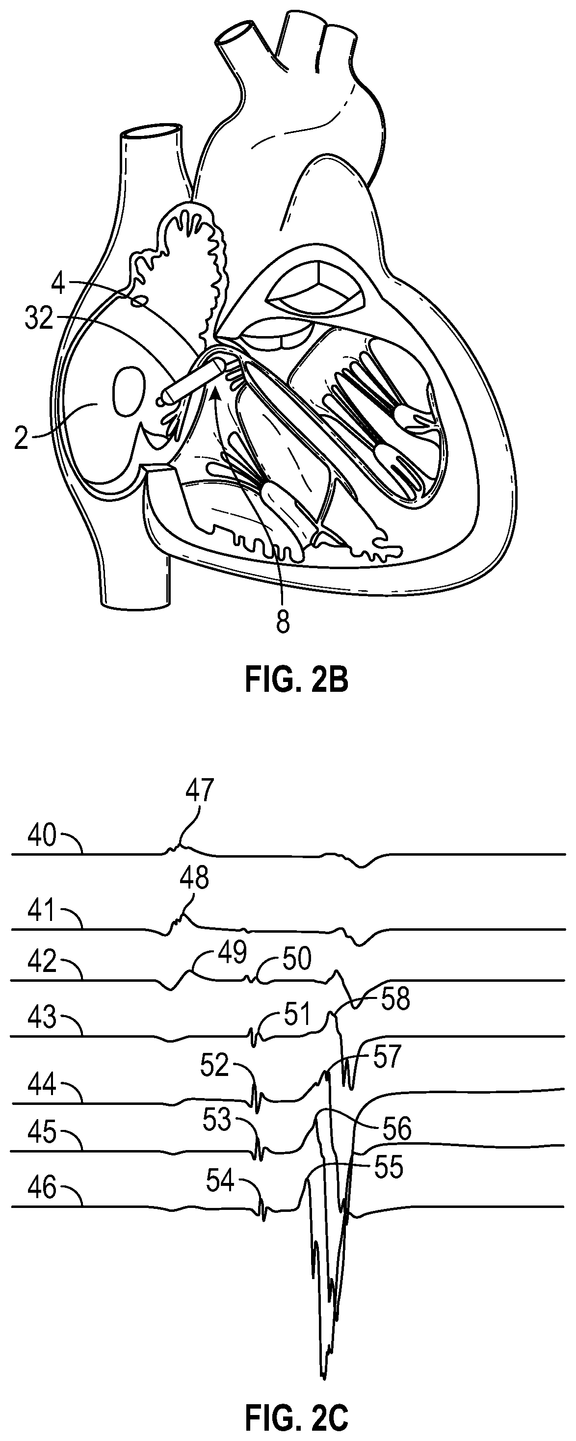 Systems, devices, and methods for his bundle cardiac pacing
