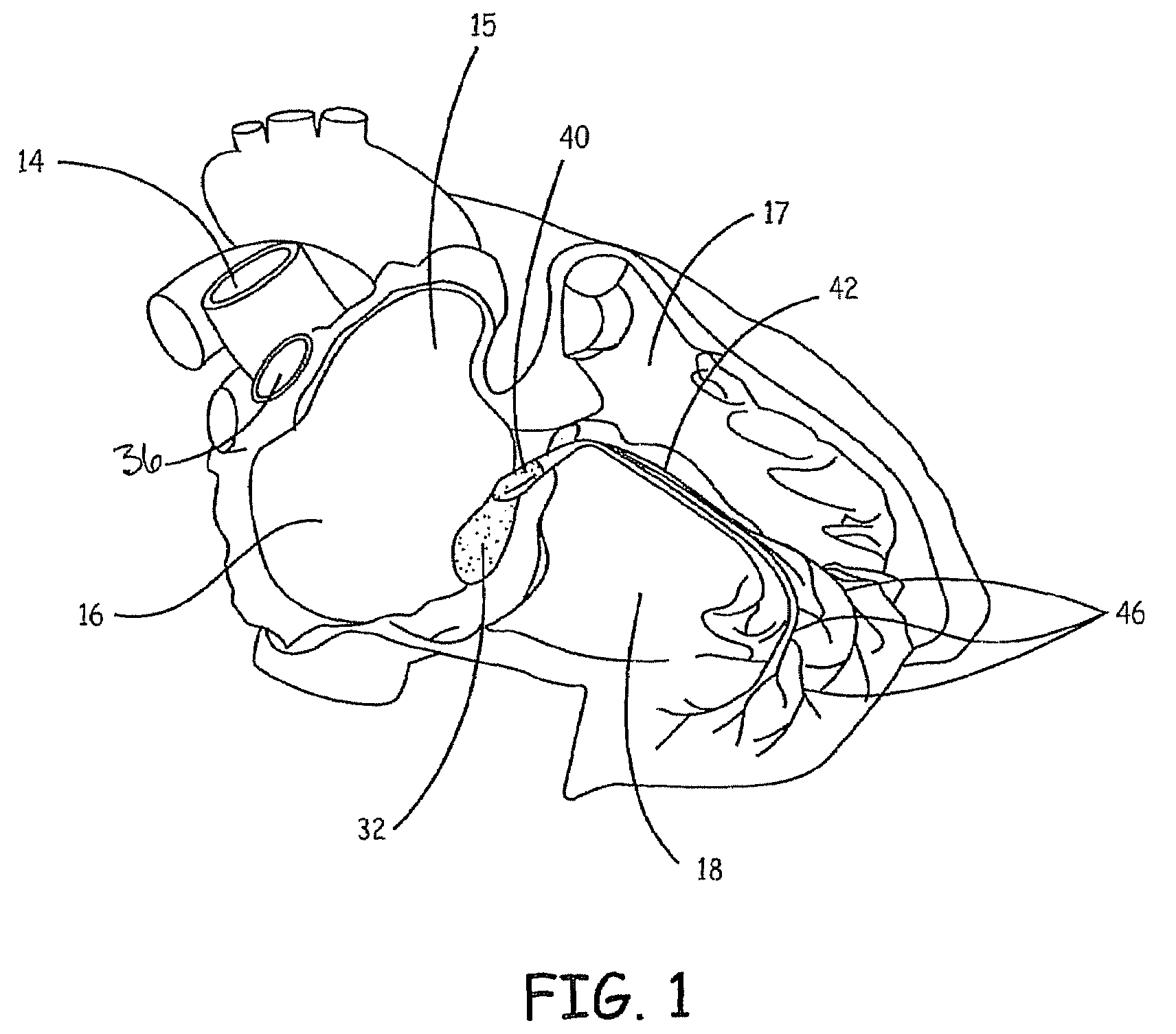 Electronic and biological pacemaker systems