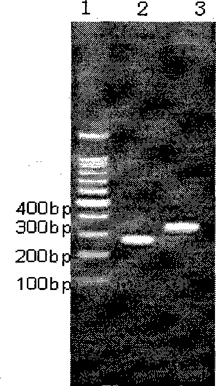 Human streptococcus mutans genetic engineering vaccine for decayed tooth and preparation method thereof