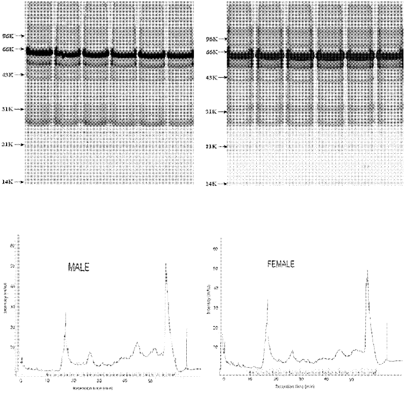 Testing kit and testing method for early screening or assisting diagnosis of urinary system diseases as well as applications of testing kit and testing method