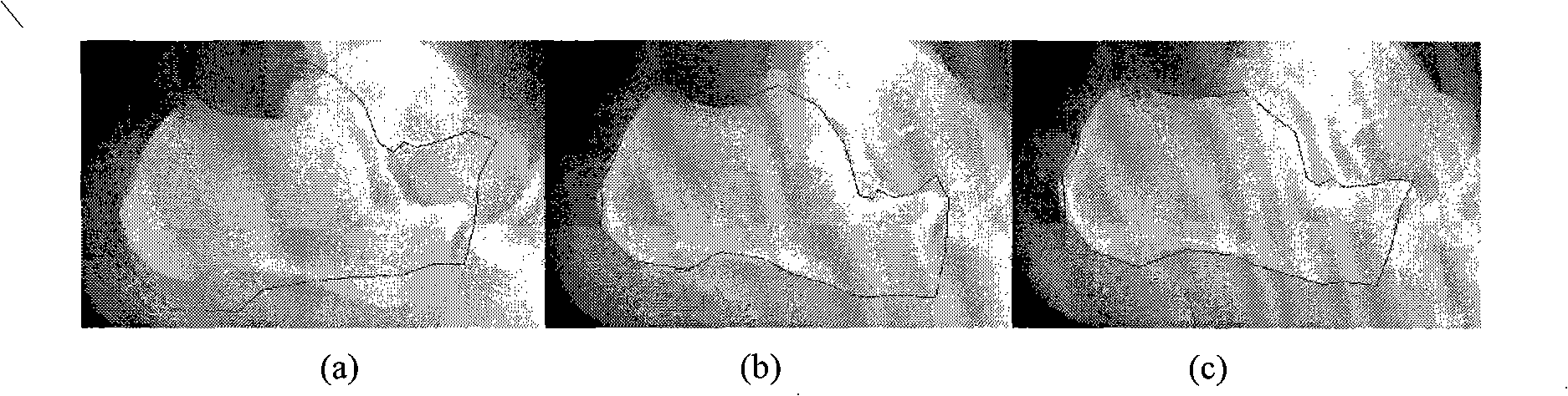 Method for analysis of picture distortion based on constant moment