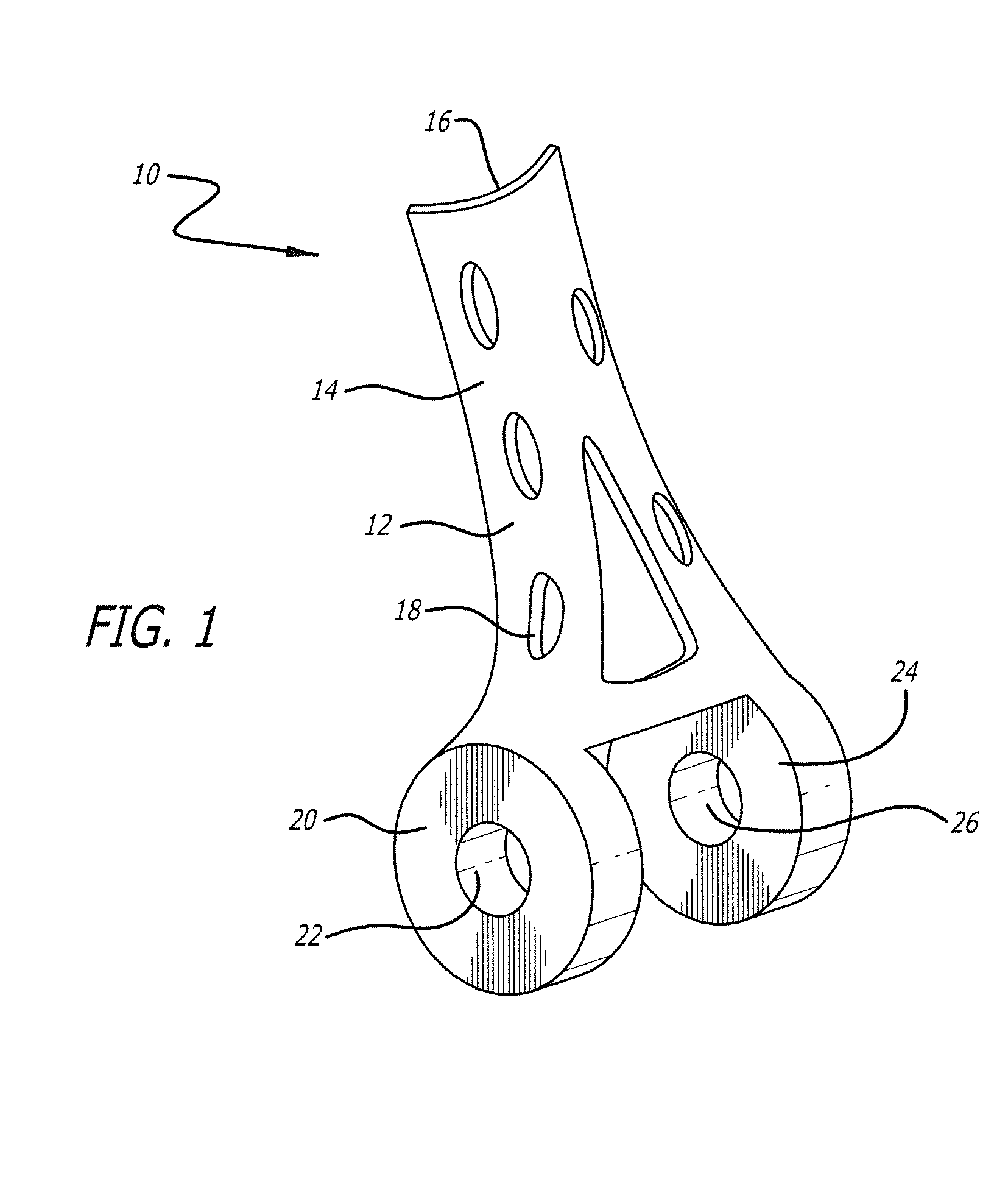 Bone joint replacement and repair assembly and method of repairing and replacing a bone joint