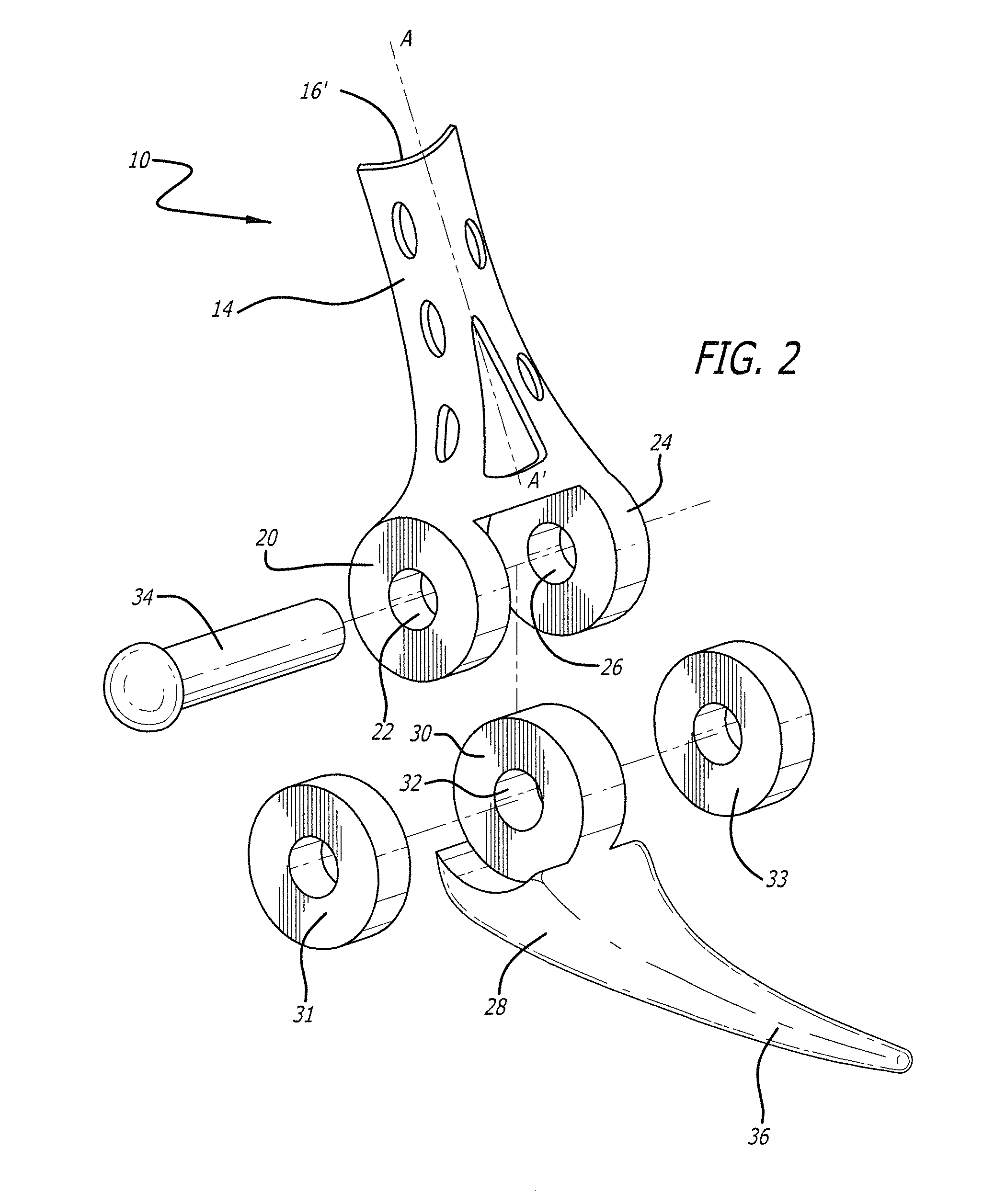 Bone joint replacement and repair assembly and method of repairing and replacing a bone joint