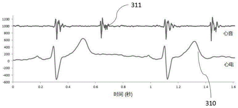 Wearable heart sound and electrocardio feature information collecting and monitoring system