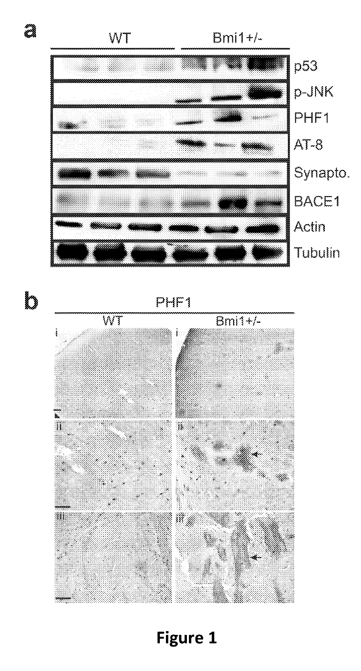 Cortical neuron cell model of alzheimer's disease based on bmi1 deficiency, and uses thereof