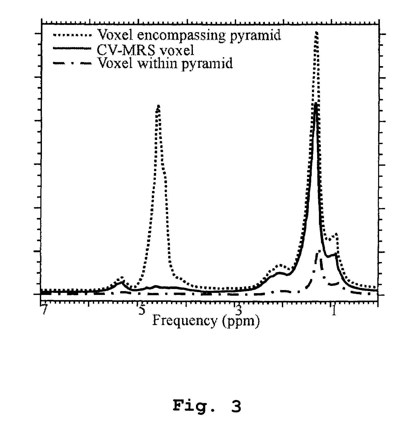 Magnetic resonance spectroscopy using a conformal voxel