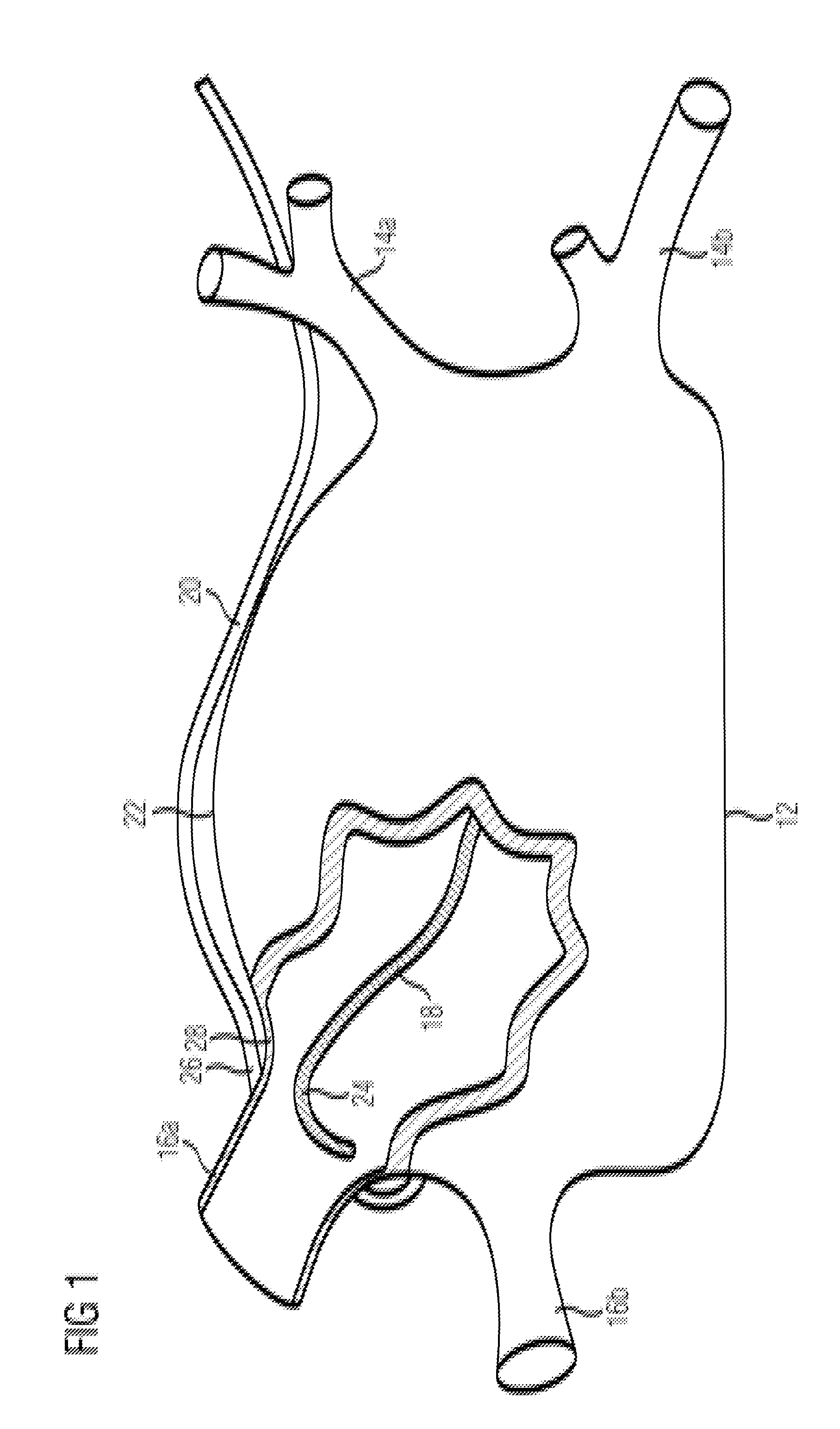 Pair of endocardial and epicardial catheters, catheter and method for positioning electrodes on a cardiac wall and method for the ablation of cardiac muscle tissue