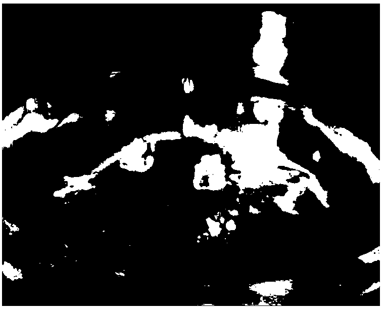 Efficient inducing method of anthurium andraeanum lind polyploid