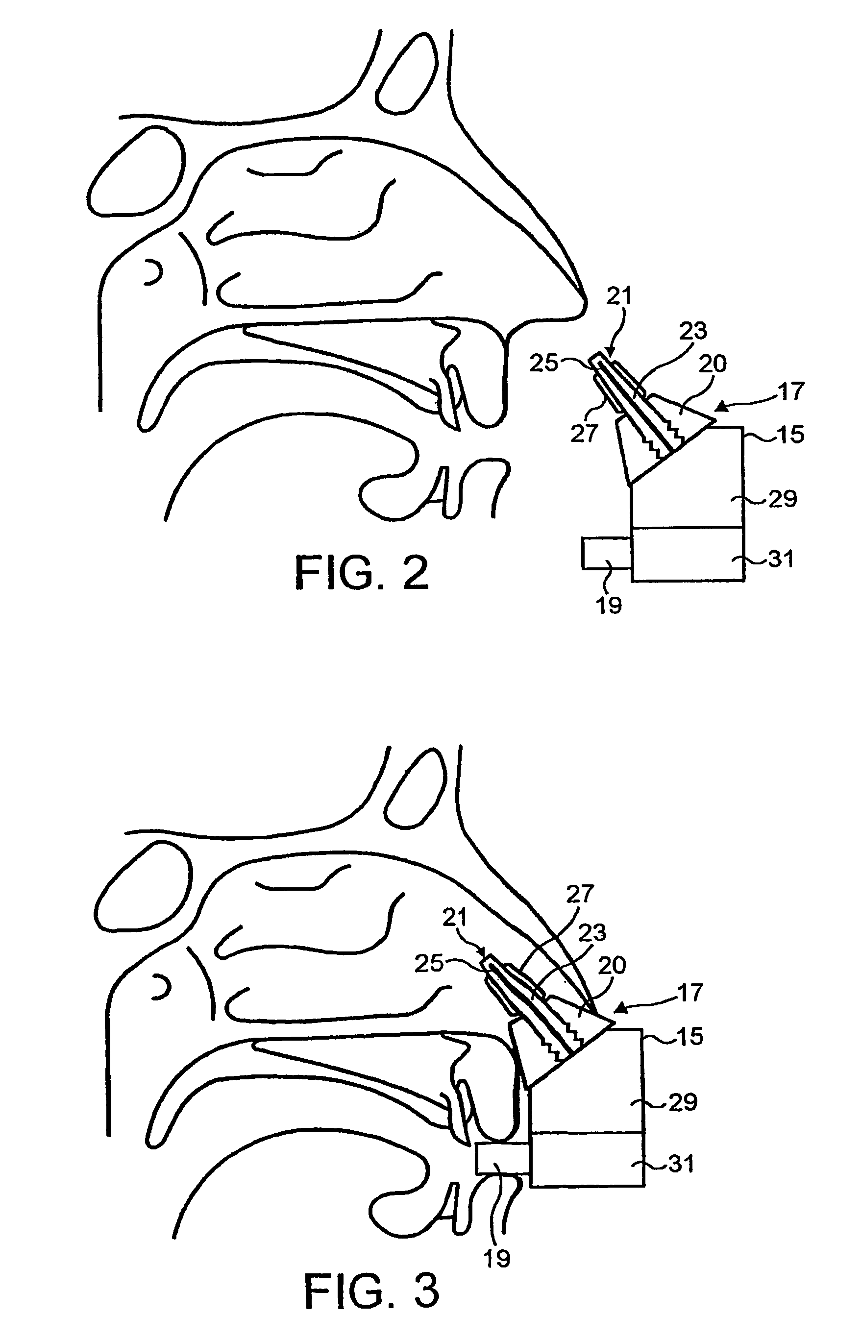 Nasal devices