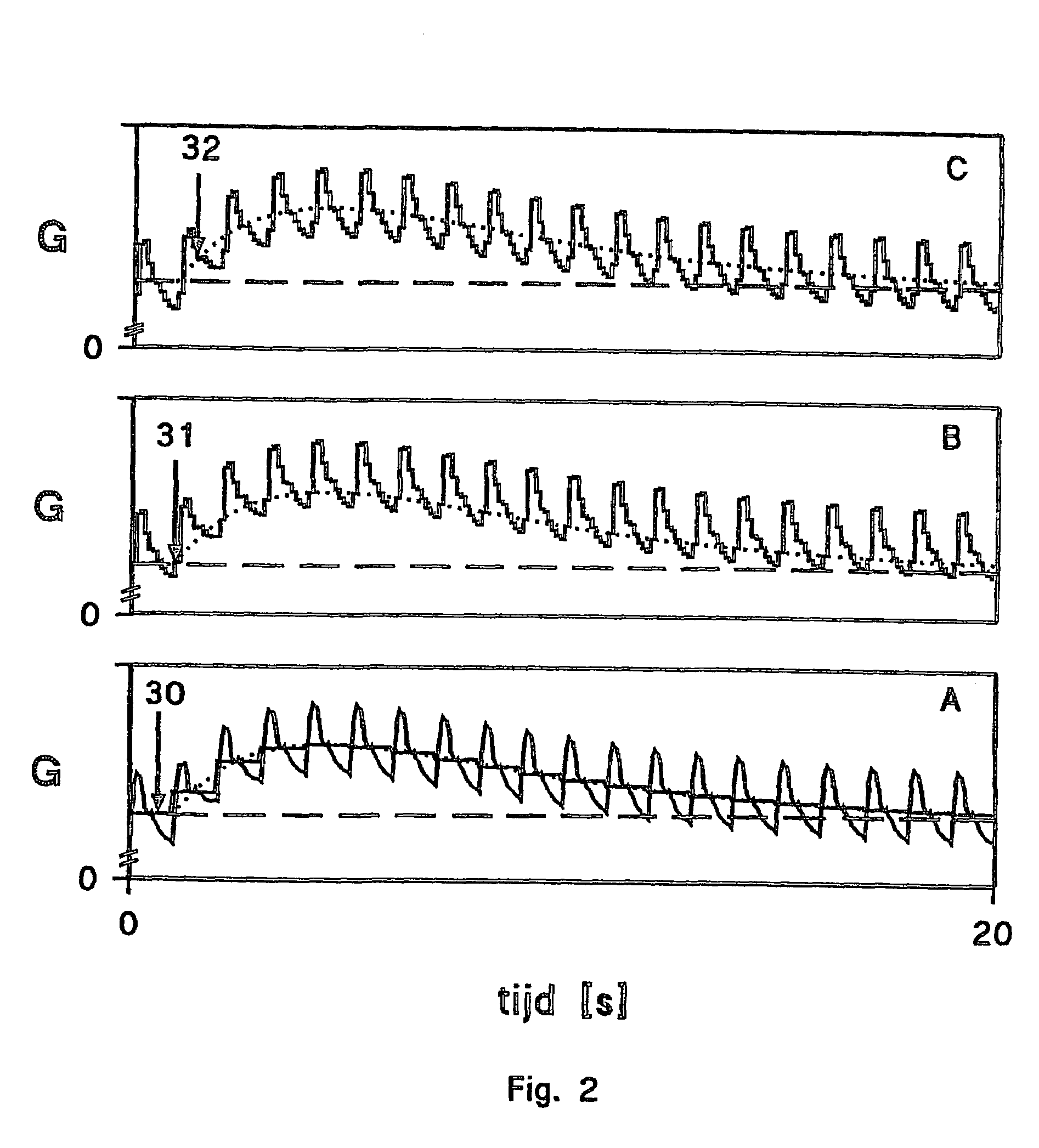 Method and device for determining the segmental volume and electrical parallel conductance of a cardiac chamber or blood vessel