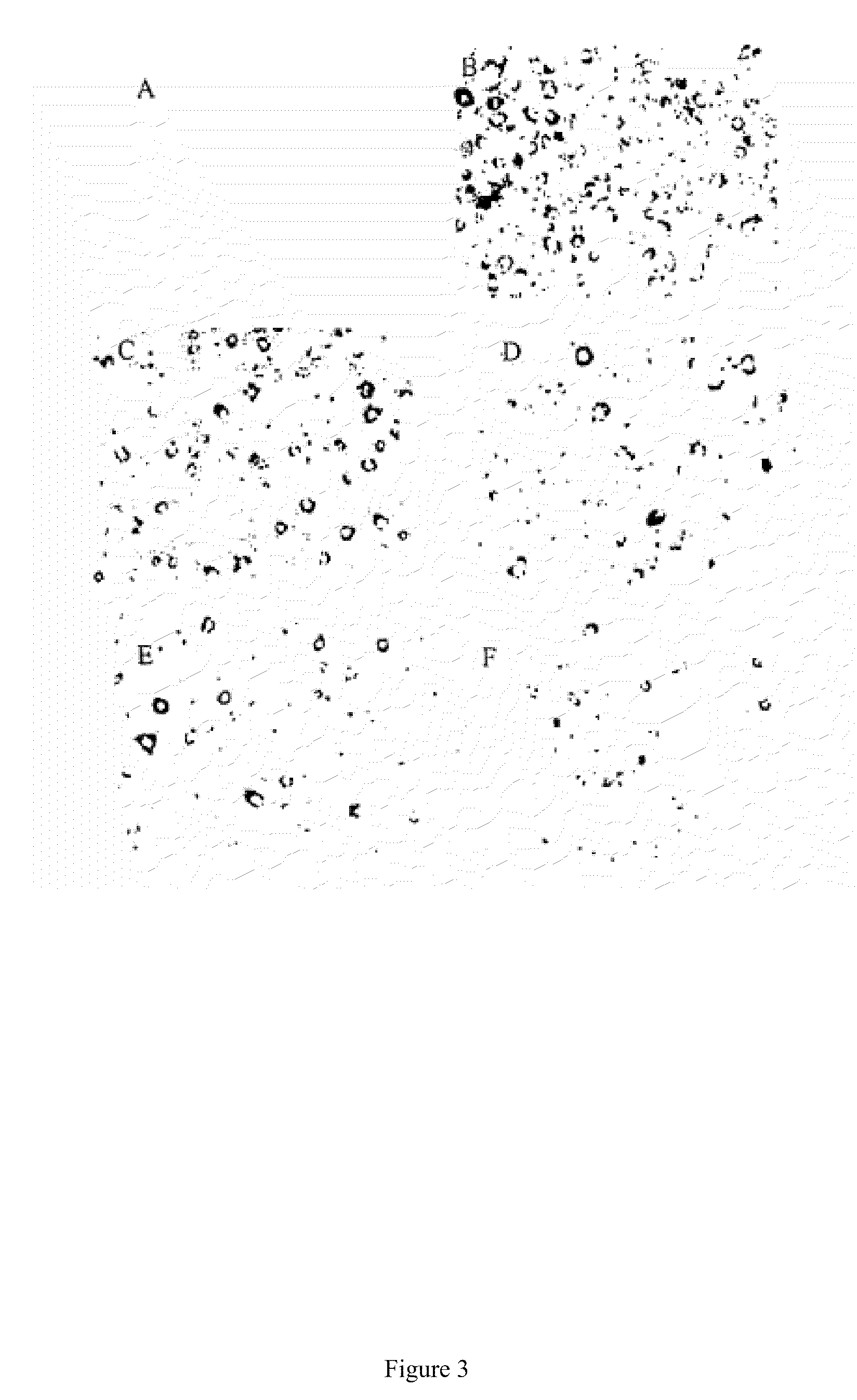 Pharmaceutical compositions containing berberine for treatment or prevention of weight gain and obesity associated with anti-psychotic drugs