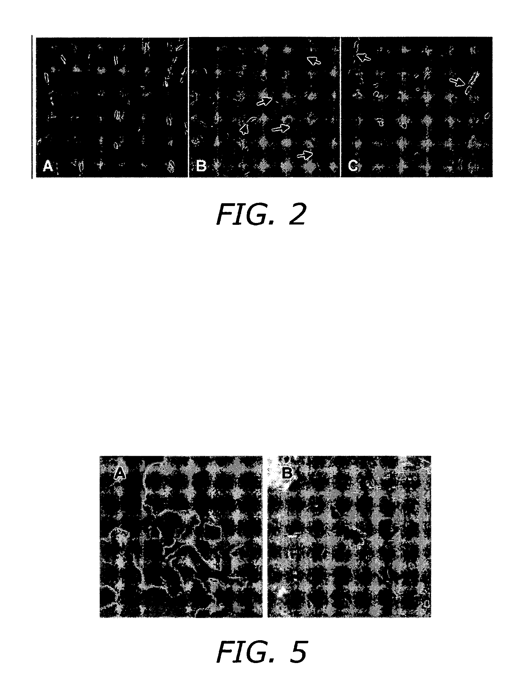 Isolation of endothelial progenitor cell subsets and methods for their use