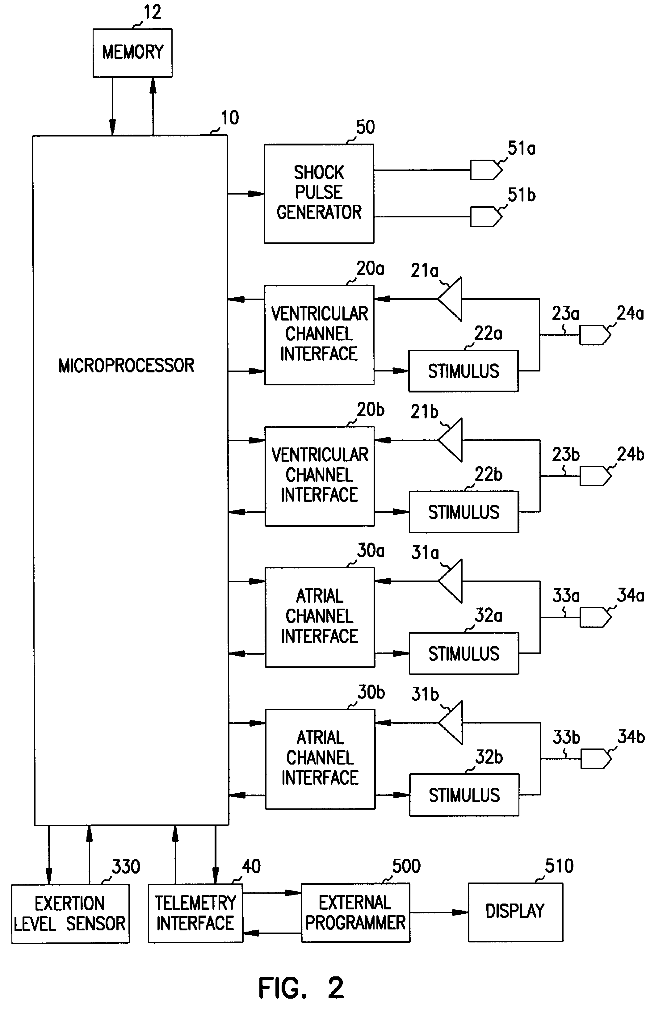 Apparatus and method for ventricular rate regularization
