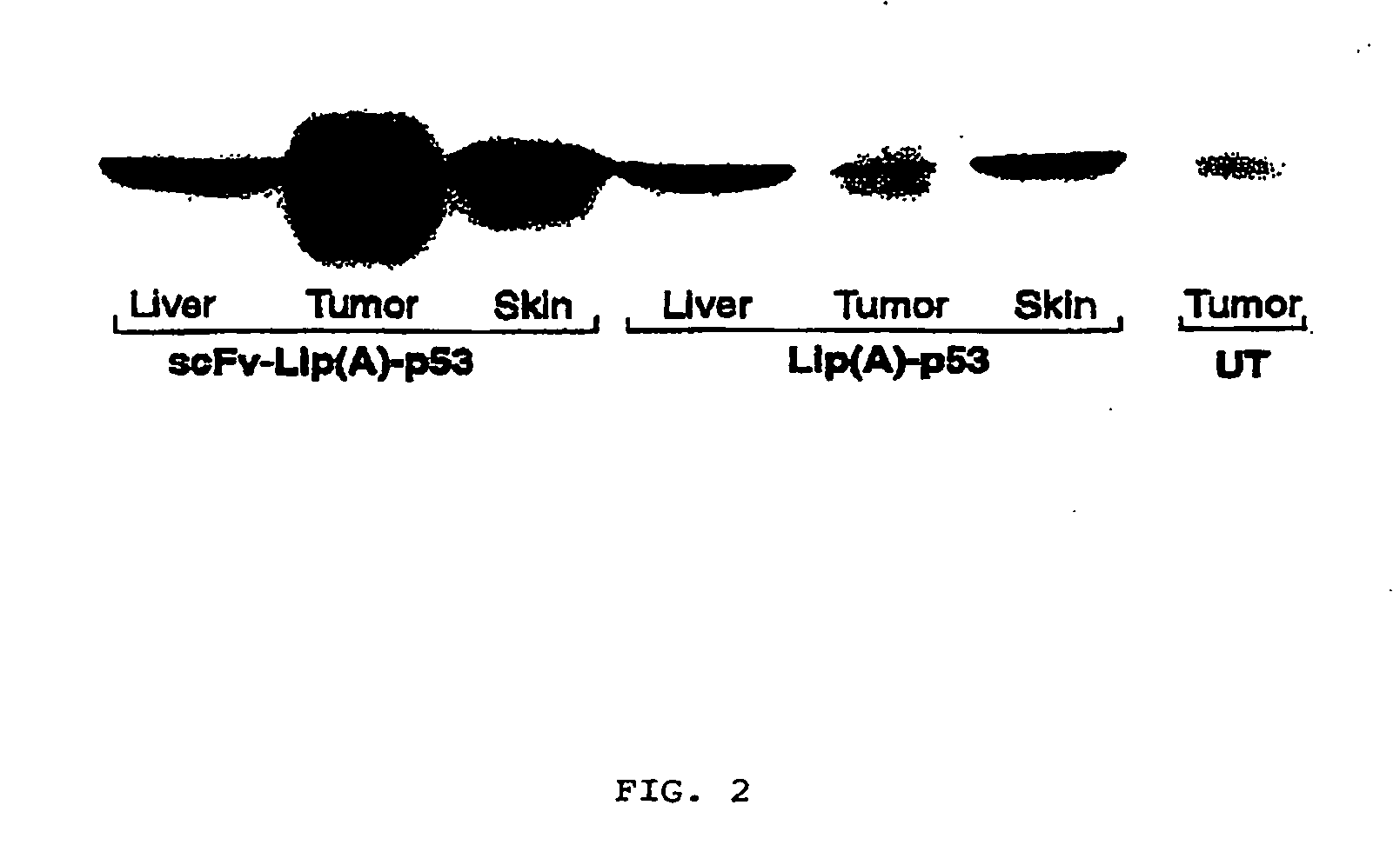 Antibody fragment-targeted immunoliposomes for systemic gene delivery