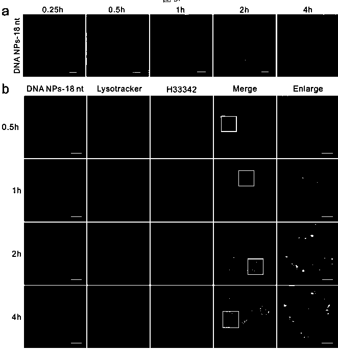 Preparation method and application of nucleic acid spherical nano particle drug