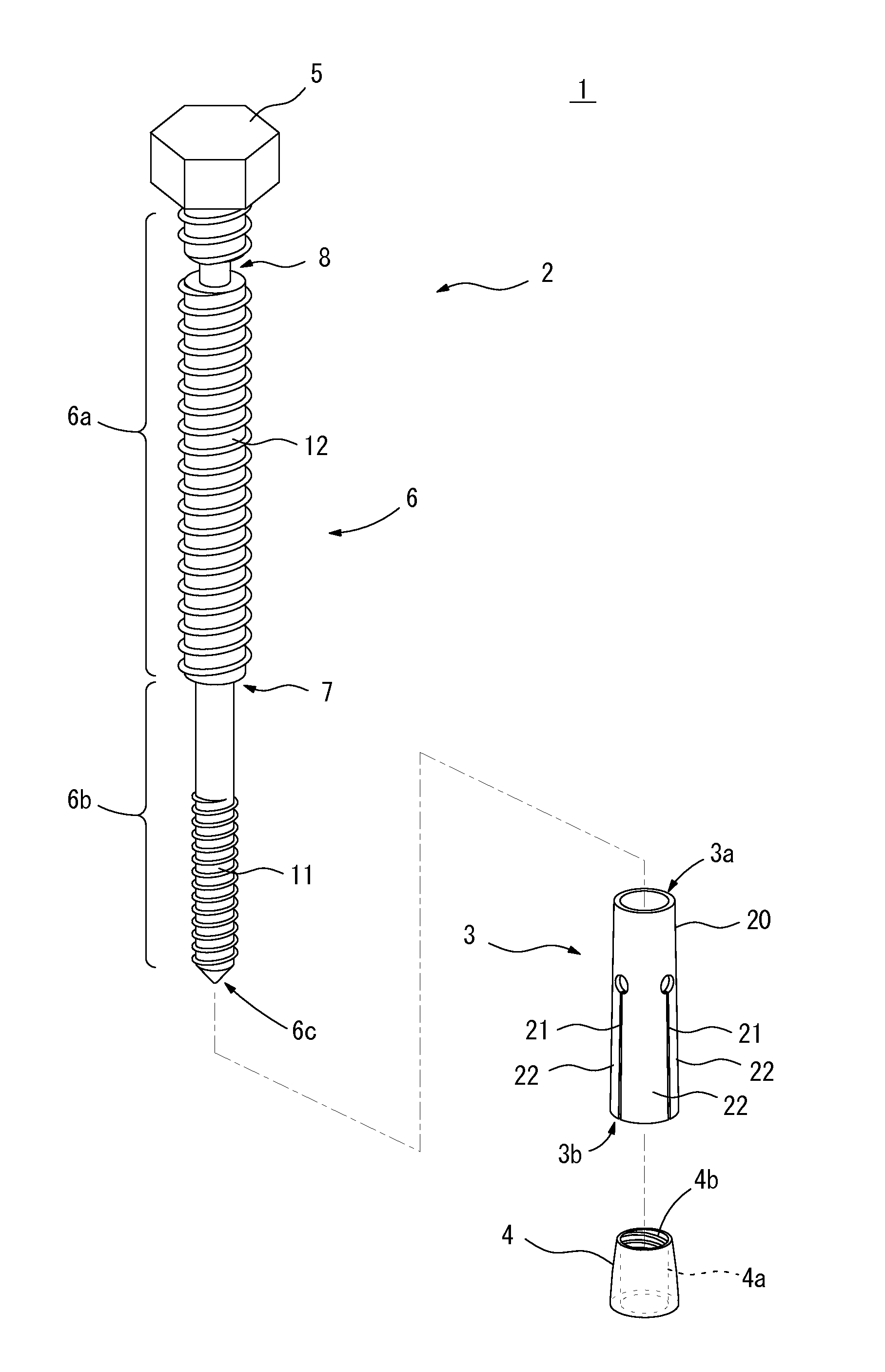 Anchor and method of installing anchor