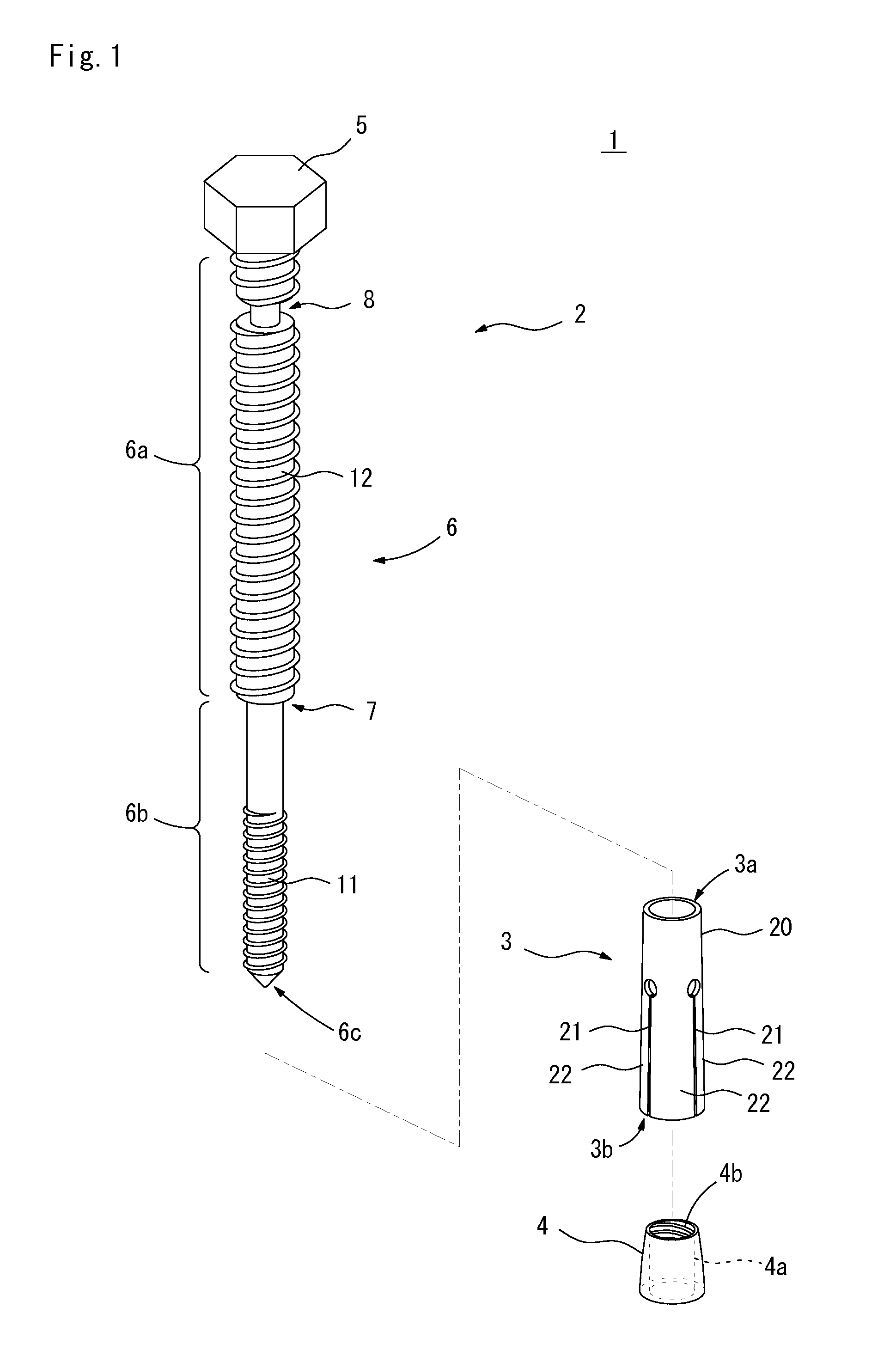 Anchor and method of installing anchor