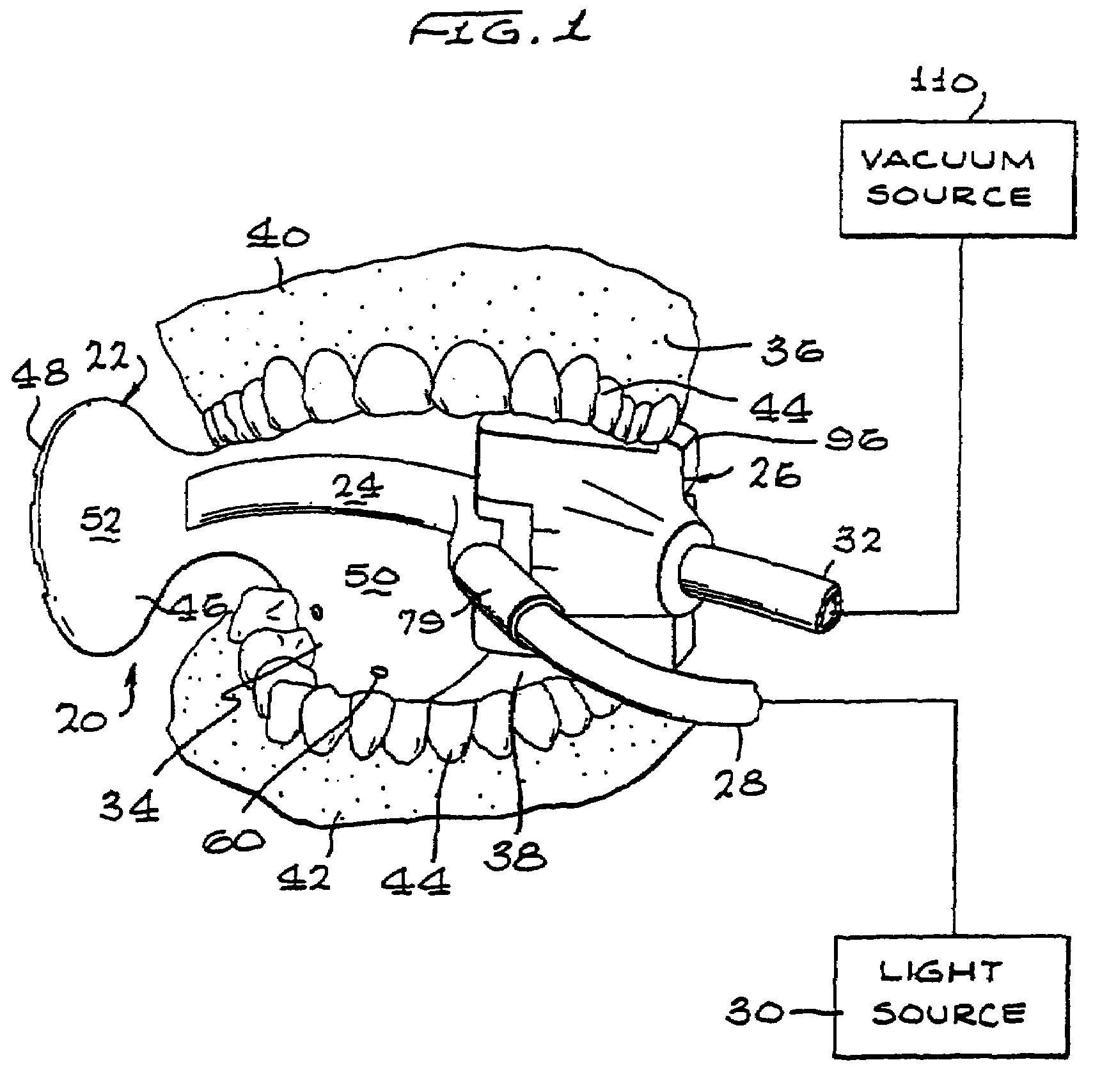 Cooling device and method for intraoral device illumination source