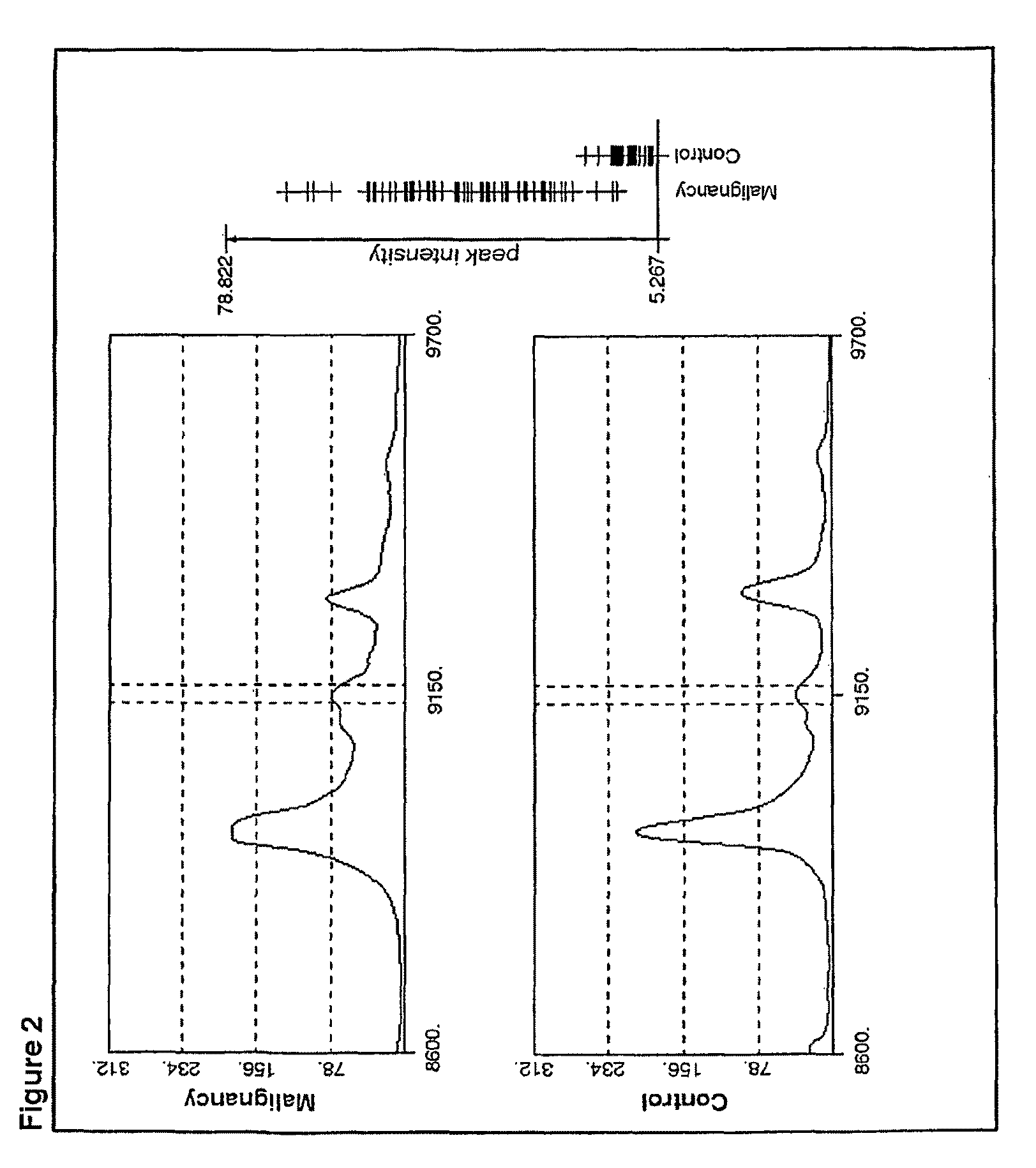 Identification of biomarkers by serum protein profiling