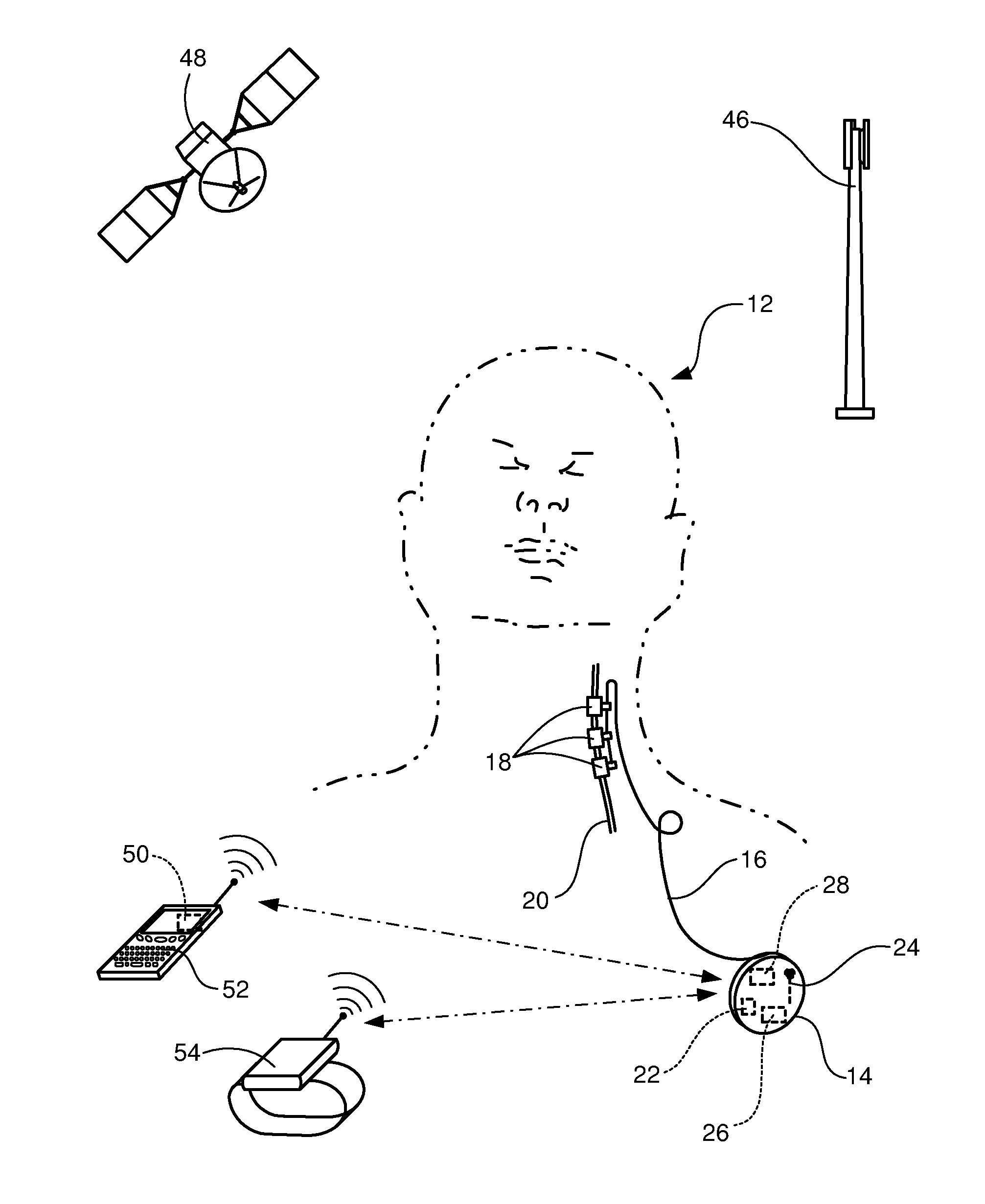 Battery life estimation based on voltage depletion rate