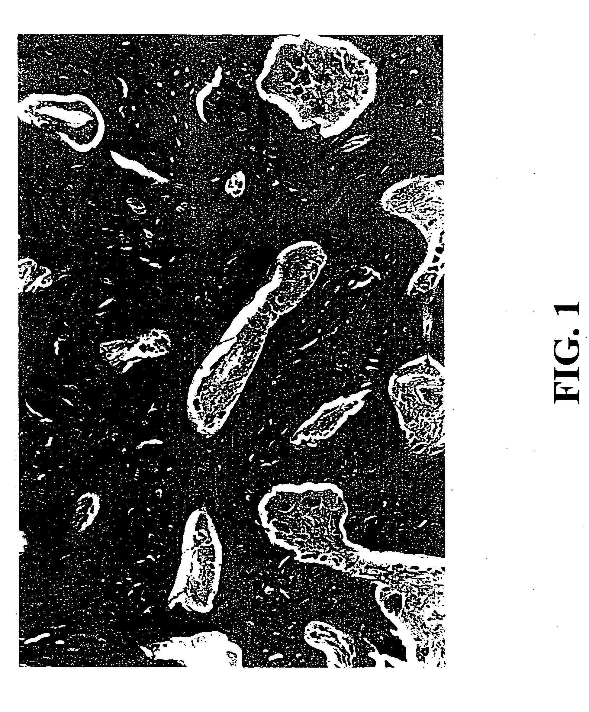 Transplantable particulate bone composition having high osteoinductive capacity and methods for making and using same