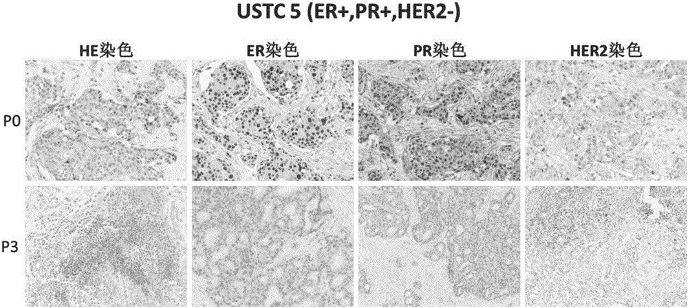 Construction method and application of model for xenograft tumors from different subtype Chinese patients with breast cancer