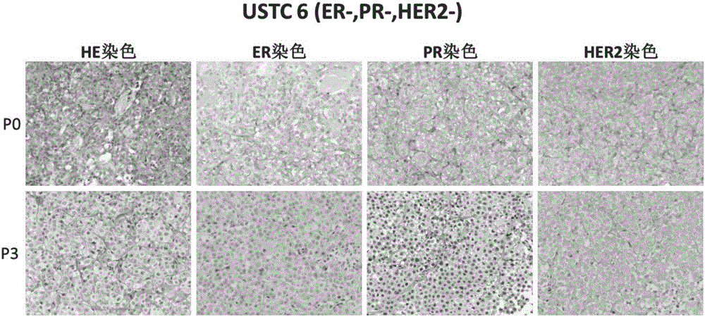 Construction method and application of model for xenograft tumors from different subtype Chinese patients with breast cancer