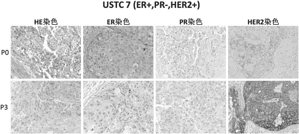 Construction method and application of model for xenograft tumors from different subtype Chinese patients with breast cancer