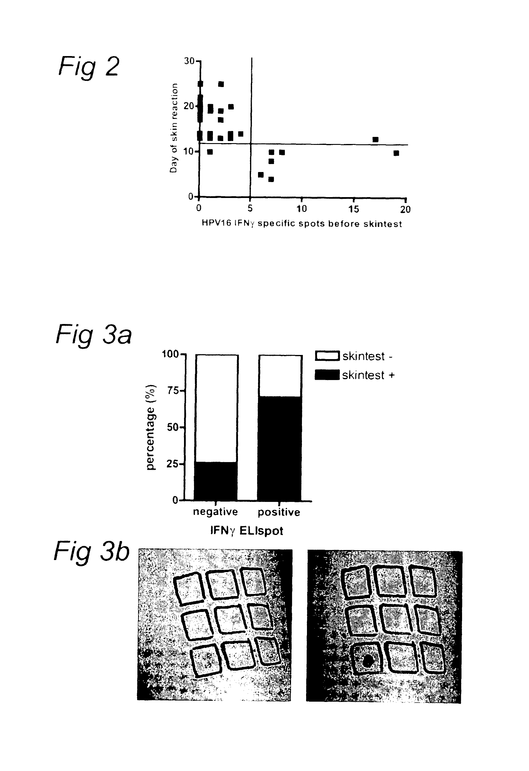 Intradermal HPV peptide vaccination