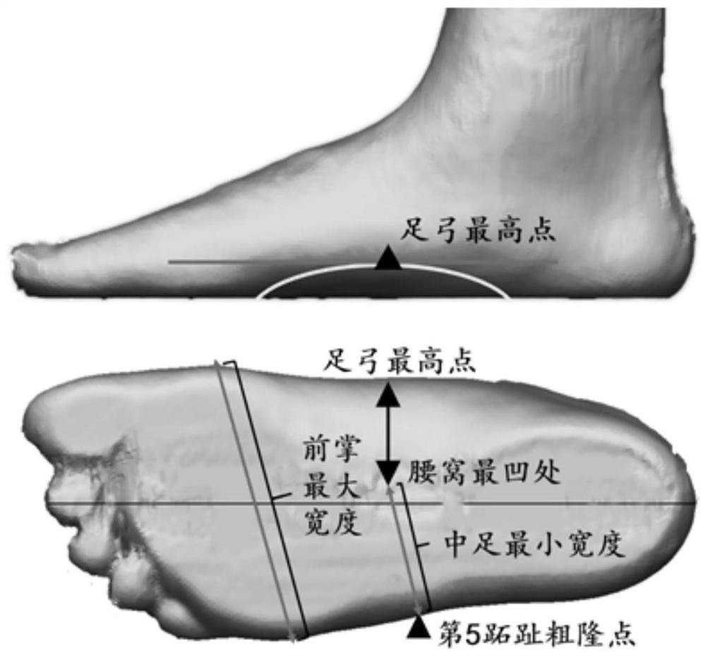 3D flatfoot correction insole design method based on arch data