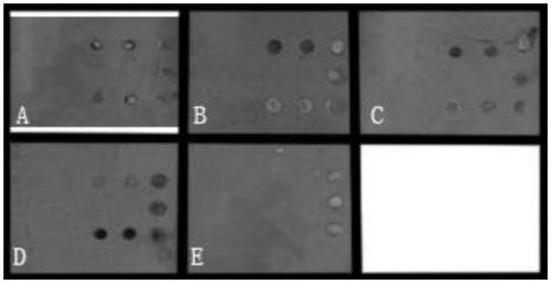 Probe, gene chip and kit for detecting il28b gene polymorphism