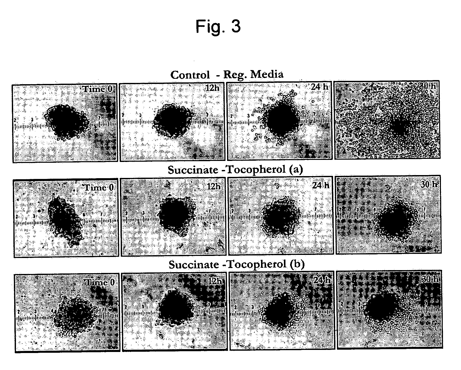 Composition and method for improving pancreatic islet cell survival