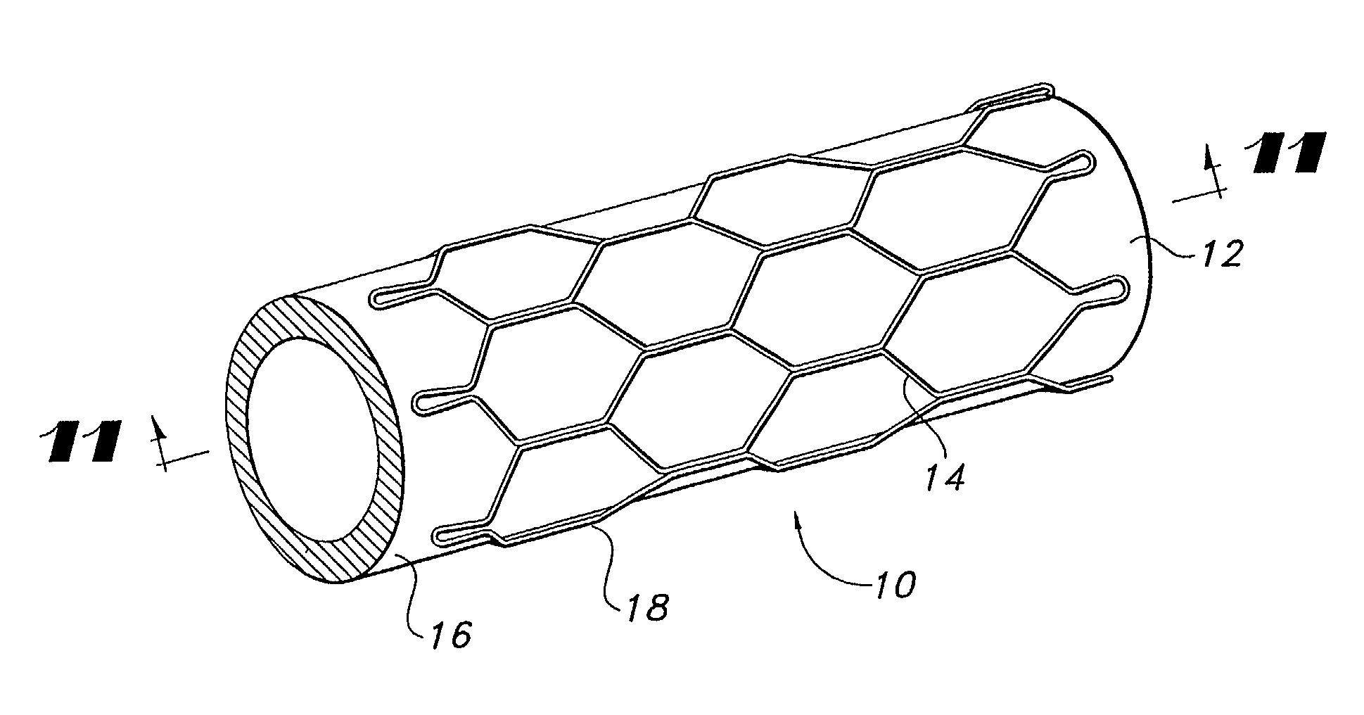 Vapor deposition process for producing a stent-graft and a stent-graft produced therefrom