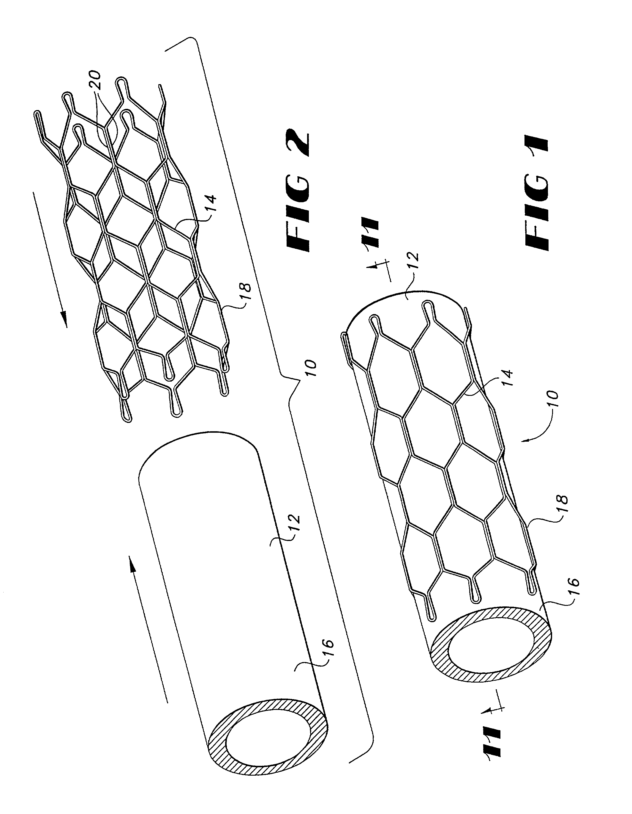 Vapor deposition process for producing a stent-graft and a stent-graft produced therefrom