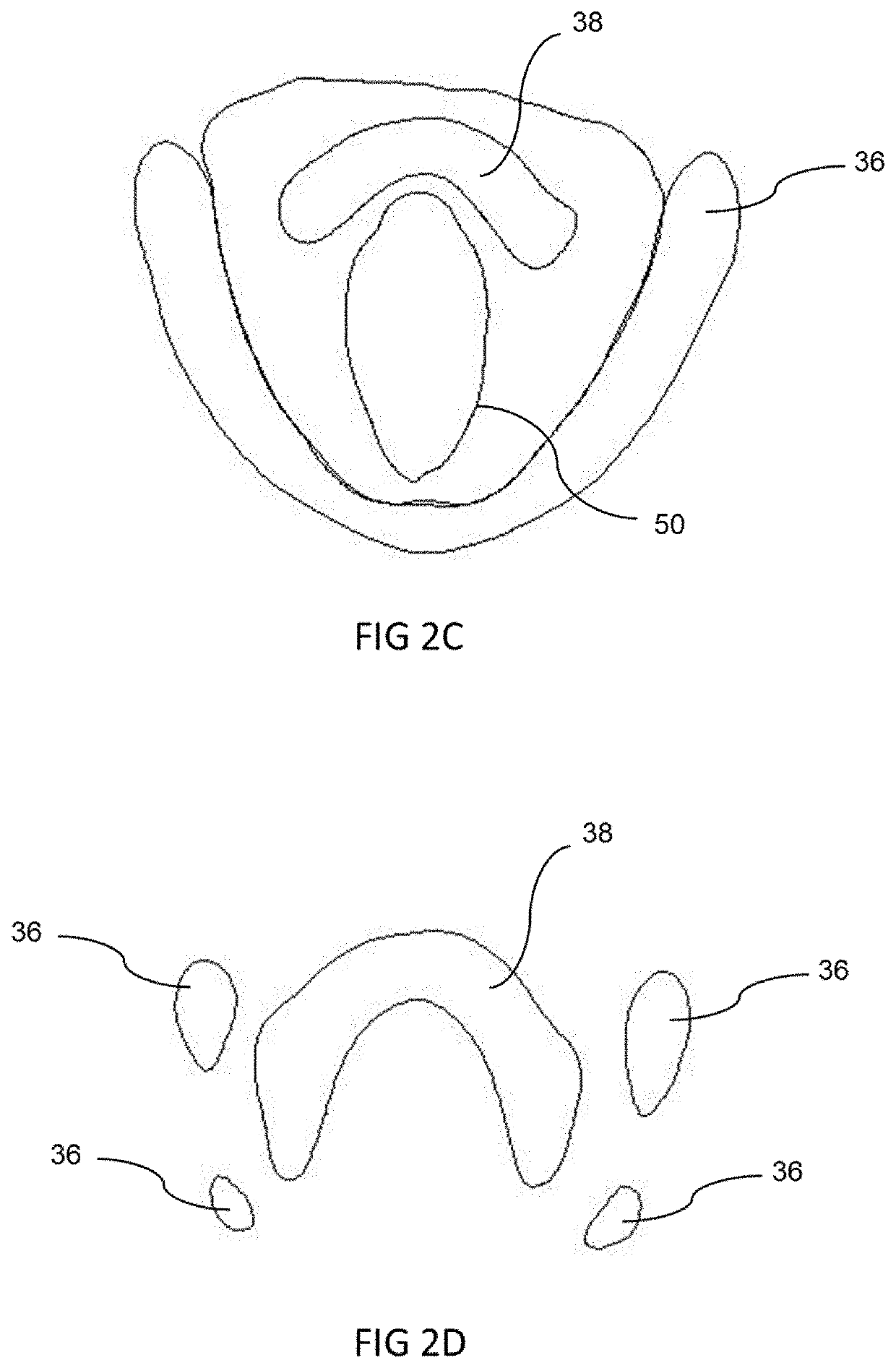 Simulator for practicing surgery or procedures involving the neck and airway and method of use thereof