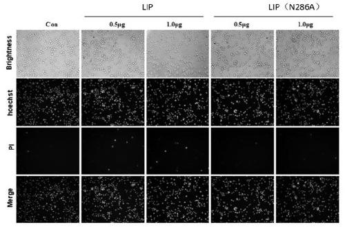 Lamprey immunoprotein LIP mutant capable of acting as tumor diagnosis marker