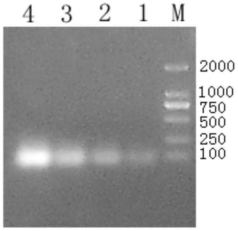 blys antagonistic peptide ss12, fusion protein ss12‑fc containing the antagonistic peptide and gene