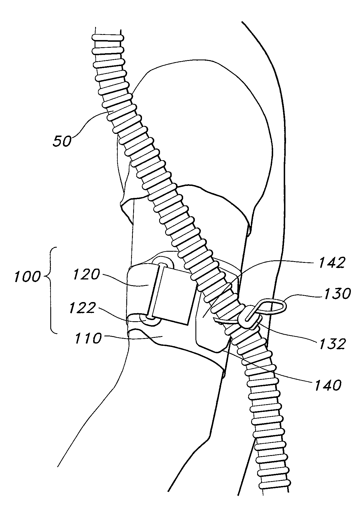 Apparatus, systems, and methods for securing a breathing tube to an arm