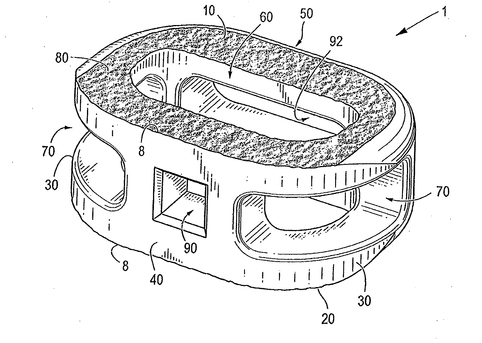 Endplate-preserving spinal implant with an integration plate having durable connectors