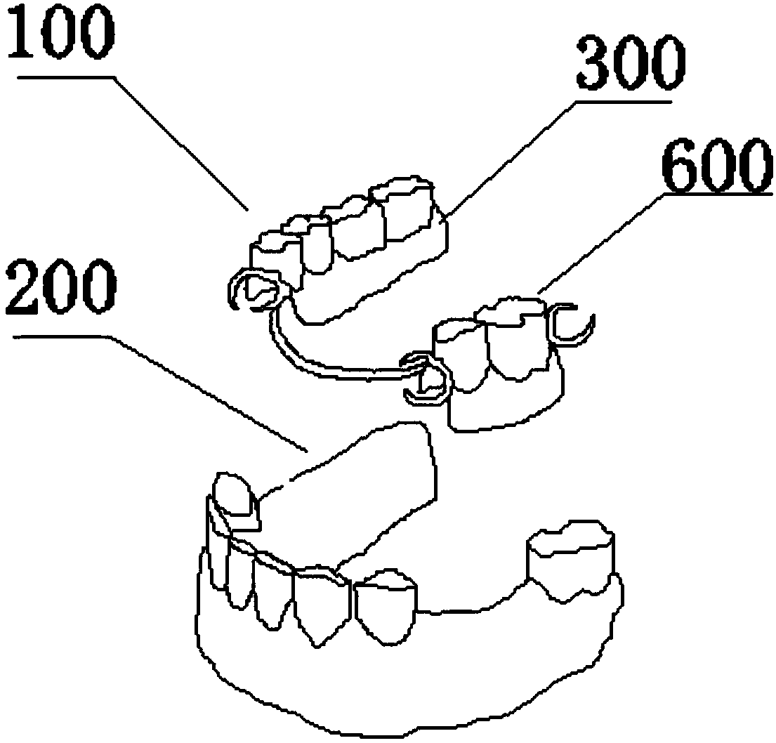 A repairing method utilizing a self-repair filing material of a removable denture