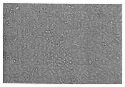 Medium and method suitable for vero cell microcarrier suspension amplification culture