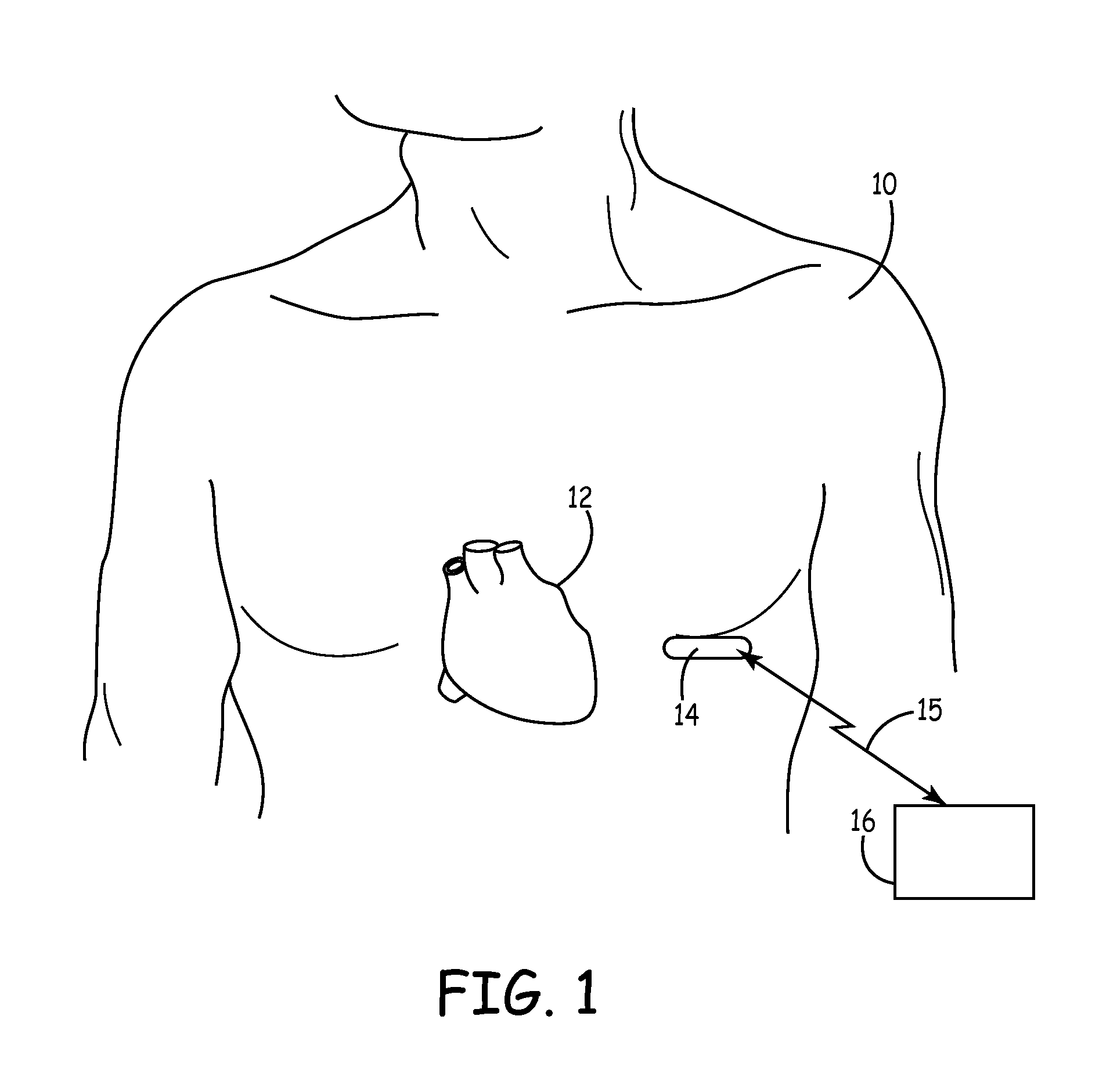 Tools and method for implanting a subcutaneous device