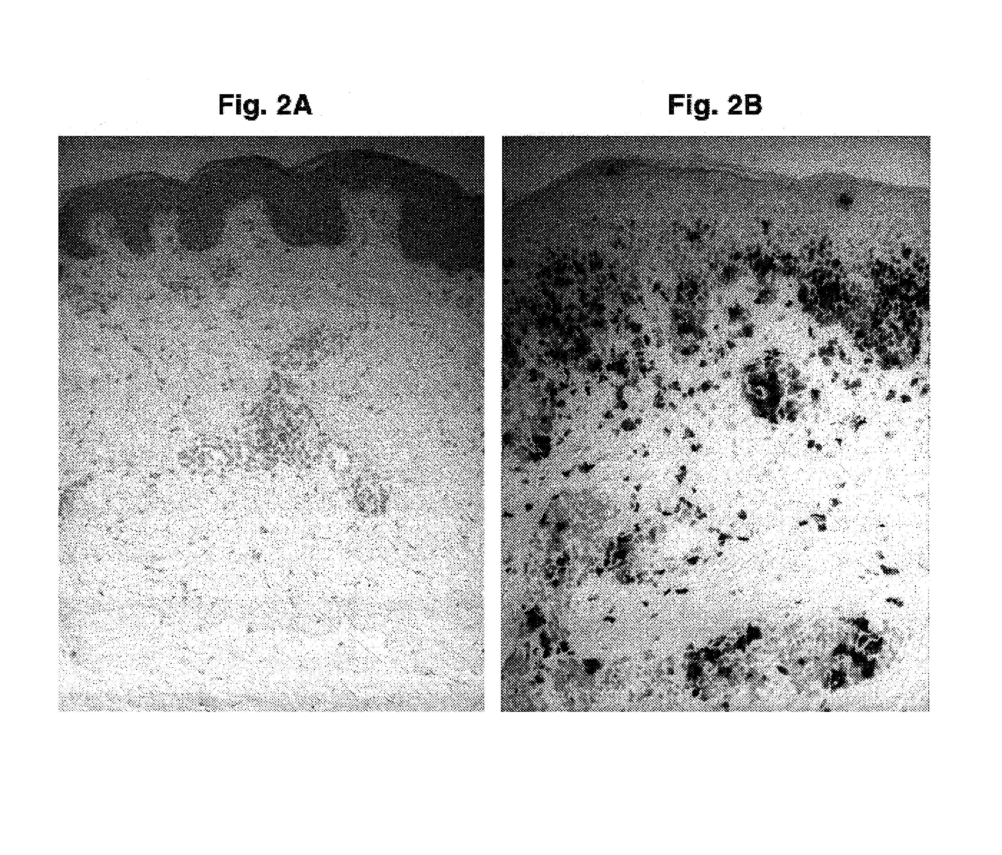 Compositions and methods for use against acne-induced inflammation and dermal matrix-degrading enzymes