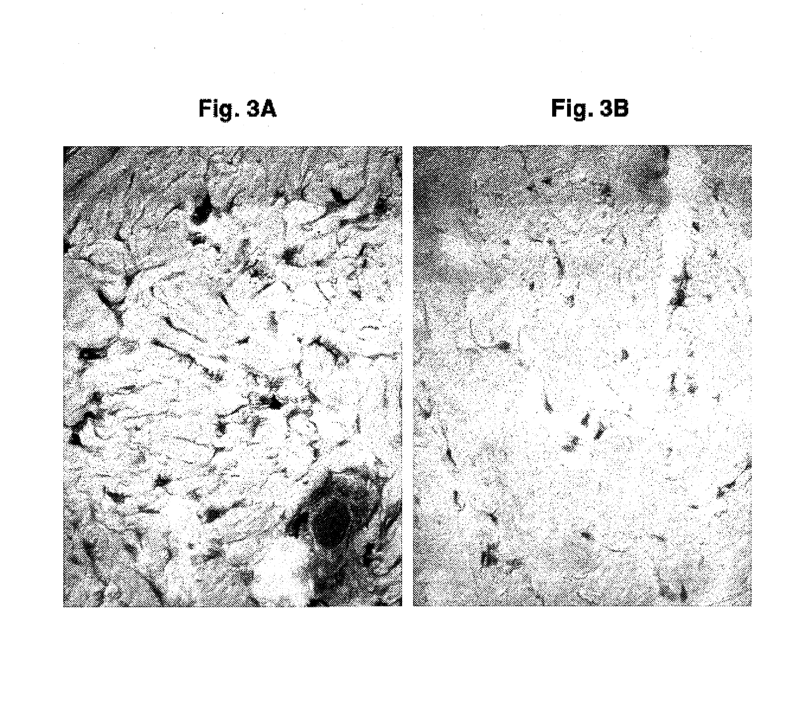 Compositions and methods for use against acne-induced inflammation and dermal matrix-degrading enzymes